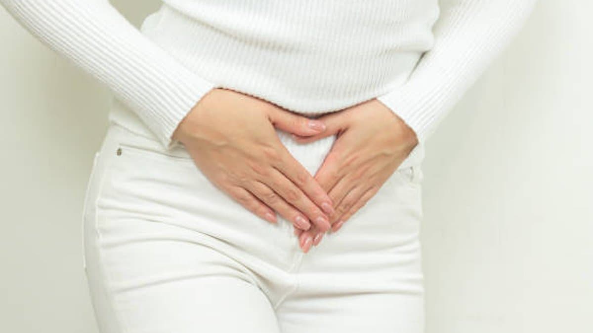 Pelvic Congestion Syndrome