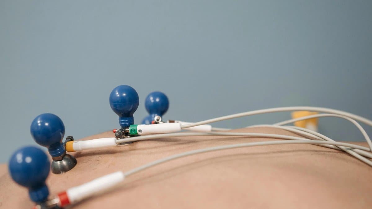 患者正在接受12导联心电图（ECG）检查