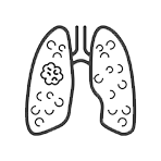 Pulmonary Embolism